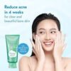 Shiseido Senka Perfect Whip Beauty Foam Medicated for Adult Acne (Blue-Green) - Image 2